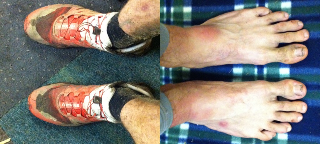 My shoes and feet after running 60 miles.